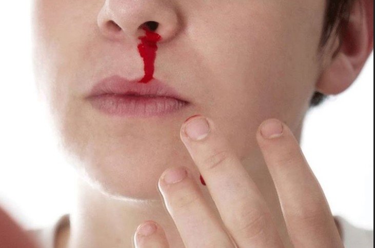 Após briga de casal de homossexual em Colíder mulher agressora e encaminhada para Delegacia.
