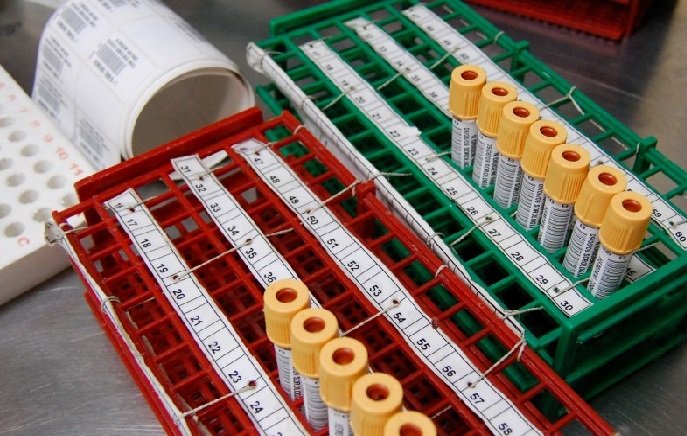Sobe para 110 número de casos de monkeypox em Mato Grosso