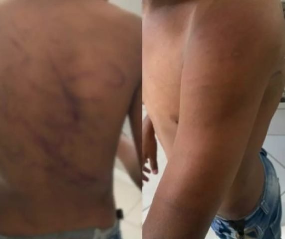 Colíder: Mãe com a ajuda de irmã dão surra em adolescente de 13 anos.