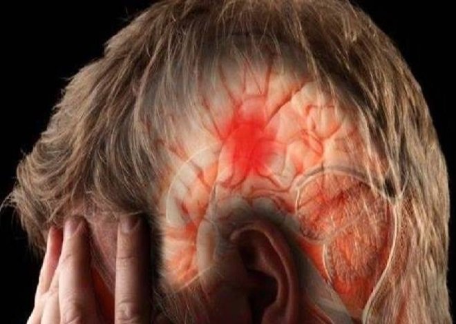 Cresce número de brasileiros mortos por acidente vascular cerebral