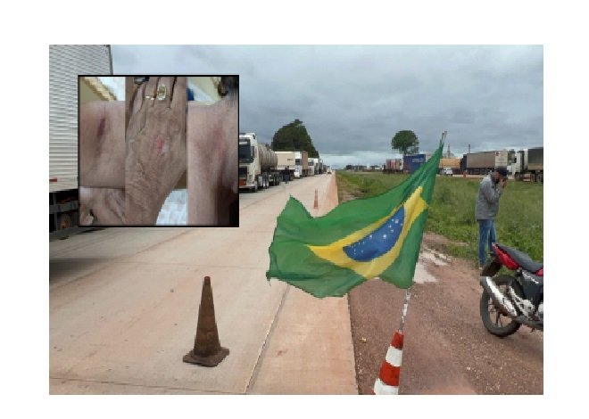Idosa é agredida por vereador de Itaúba em manifestação de direita