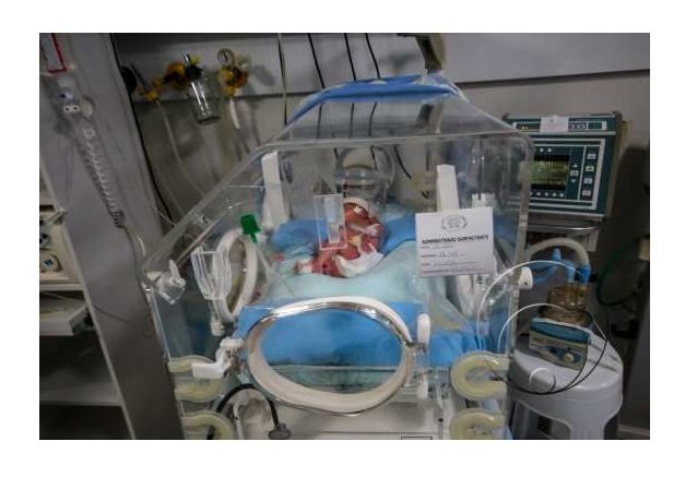 Campanha Novembro Roxo faz alerta sobre importância do pré-natal para evitar prematuridade