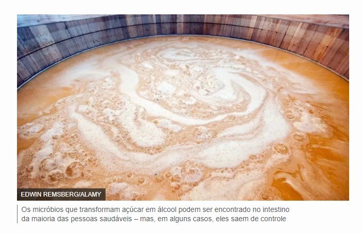 A misteriosa síndrome que deixa pessoas bêbadas com álcool produzido no próprio estômago