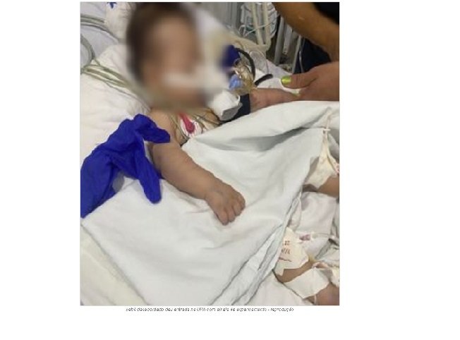 Bebê de 2 meses morre em Sinop após dar entrada na UPA com sinais de espancamento e queimaduras
