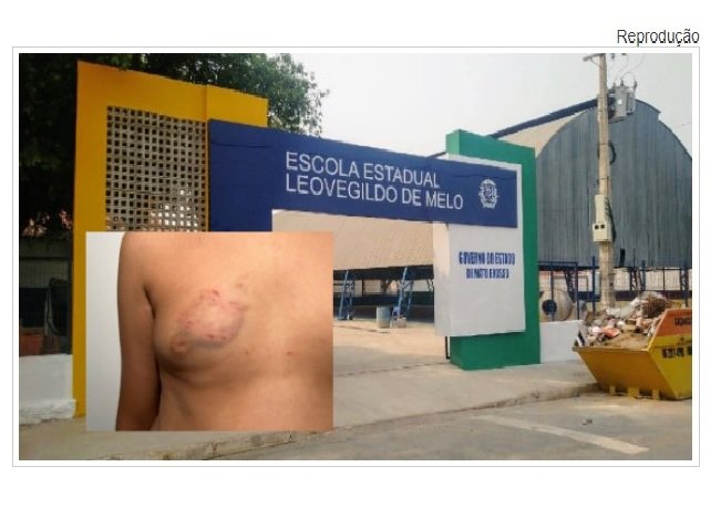 Mãe registra BO após filho de 10 anos ser mordido e levar pedradas de adolescente