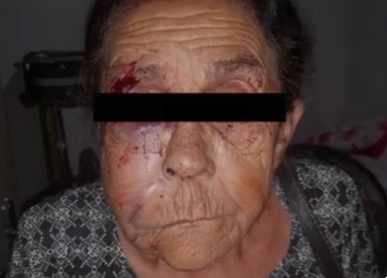 Idosa é espancada pelo filho até desmaiar, porque TV não funcionava direito