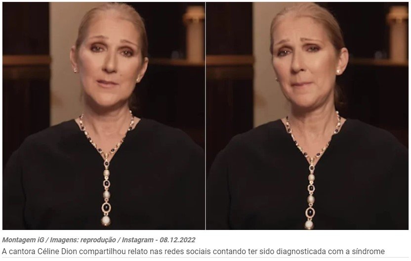 Entenda a doença rara de Céline Dion, síndrome da pessoa rígida