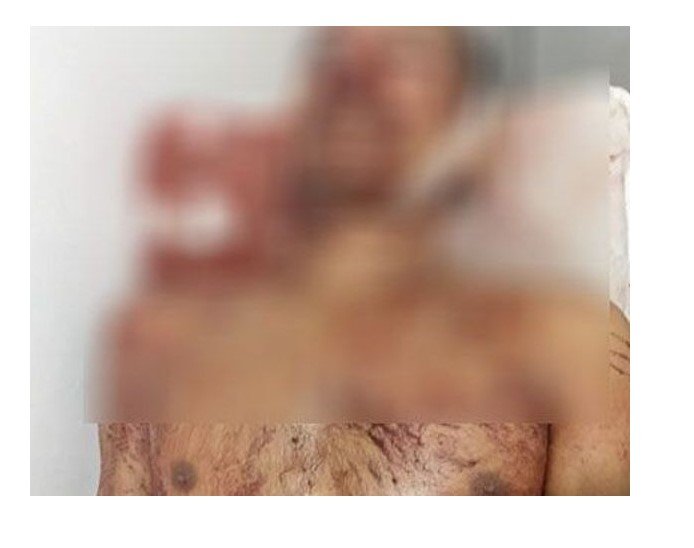 Marido mata a golpes de machado, homem no interior de MT, que estuprou esposa e ameaçou estuprá-la novamente