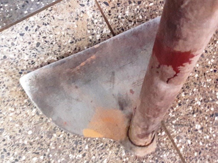 Mulher acha namorado na 'zona', leva soco no olho e o pai dela corre atrás de agressor com enxada