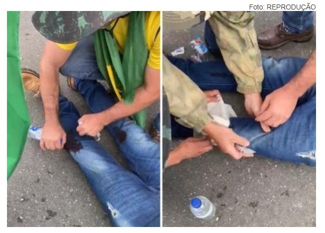 VÍDEO: Homem é atingido por tiro na perna durante invasão