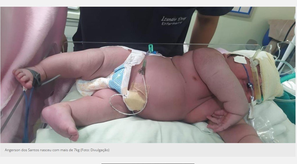 Raro: 'superbebê' nasce em hospital de Parintins pesando 7,3 kg