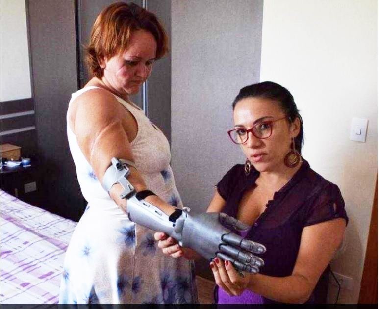 CAMPO NOVO DOS PARECIS Mulher que teve as mãos decepadas pelo marido faz campanha para adquirir próteses
