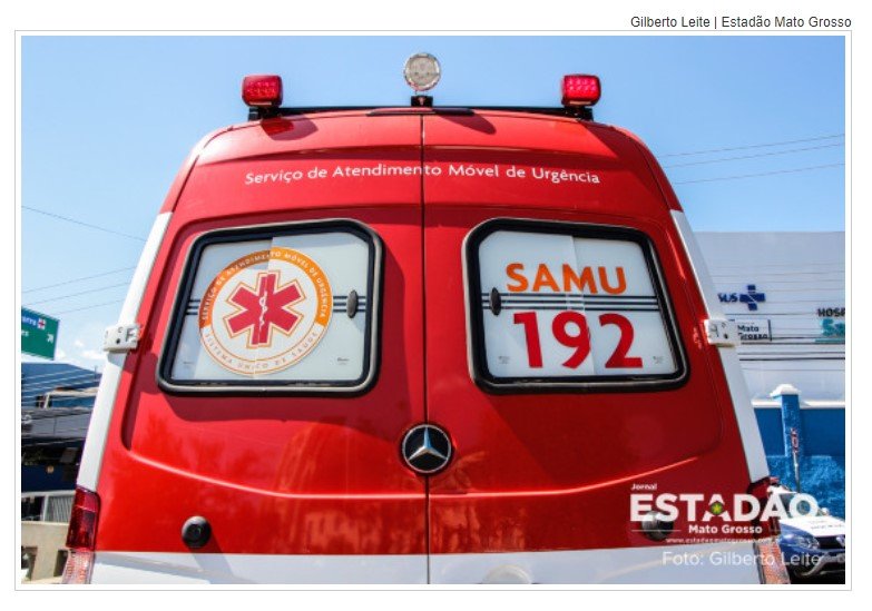 Mulher tem queimaduras de 2º e 3º graus em 80% do corpo ao ser incendiada por desconhecido em MT