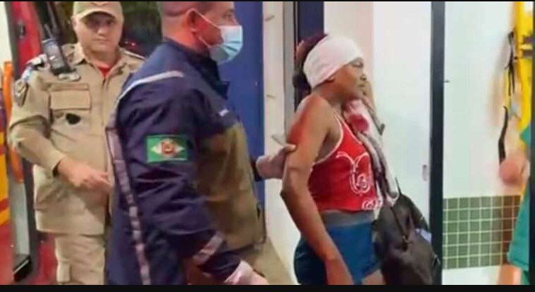 SORRISO: 'Você vai sentir um pouco de dor' disse o marido antes de cortar orelha de esposa
