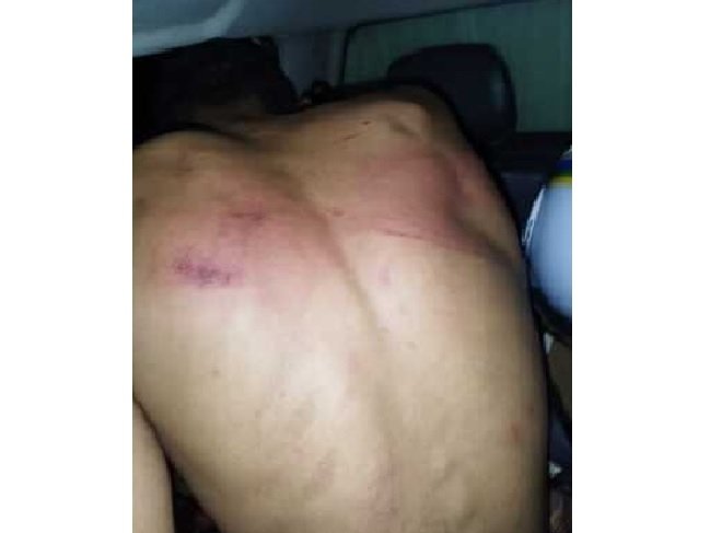 Homem leva salve de facção e consegue fugir antes de ser executado a tiros