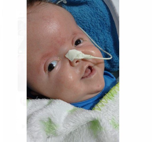 URGENTE: Bebe de 7 meses de Itaúba/MT, precisa de ajuda para fazer uma cirurgia de crânio com URGÊNCIA.
