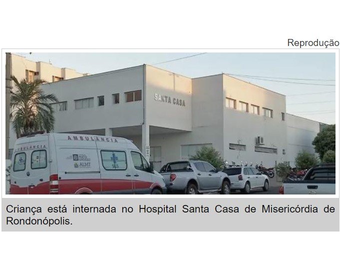 Menino de 4 anos tem múltiplas fraturas ao cair do 3° andar de prédio em MT