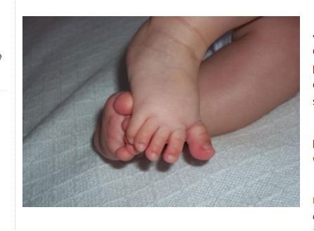 Mãe é presa acusada de fraturar perna de bebê em MT