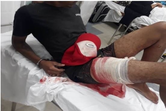 Ladrão é baleado e comparsas presos após roubo à farmácia