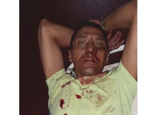 Marido denunciado por ameaçar mulher é baleado ao atirar em policiais em MT