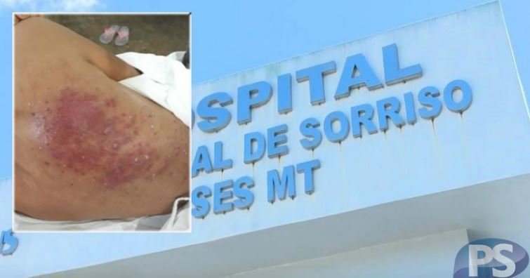 Lotação em UTI impede que idosa, que já está com as costas feridas, faça cirurgia no Hospital Regional