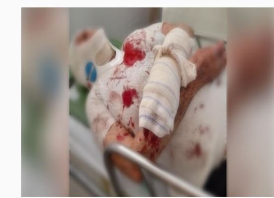 Mãe segue a filha até boca de fumo e é agredida por ela a socos e pontapés em Ipiranga do Norte