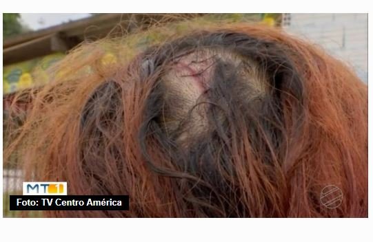 Mulher tem braço quebrado e cortes na cabeça ao ser agredida pelo marido em Várzea Grande: "É a quinta vez"