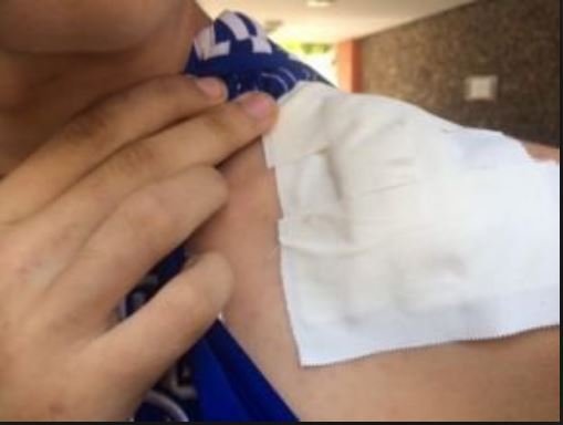 Mulher em Colíder tenta contra a vida de marido pela segunda vez com uma facada no ombro.