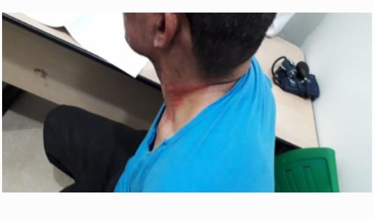 Homem diz estar possuído, ateia fogo em casa e agride militares durante resgate em Cuiabá