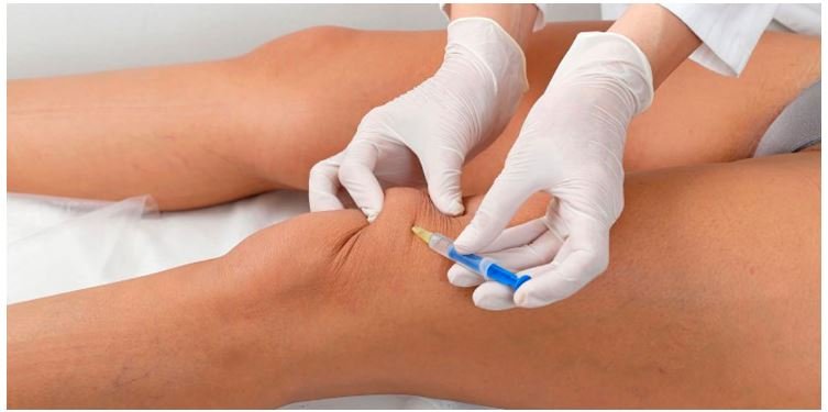 Cientistas criam medicamento que pode regenerar a cartilagem de joelhos