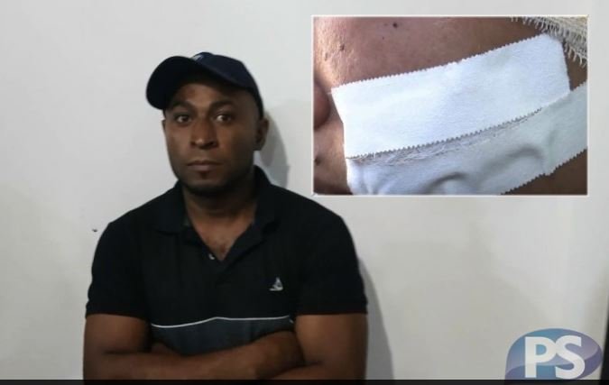Homem suspeito de decepar a orelha da ex-mulher se mantém em silêncio durante interrogatório