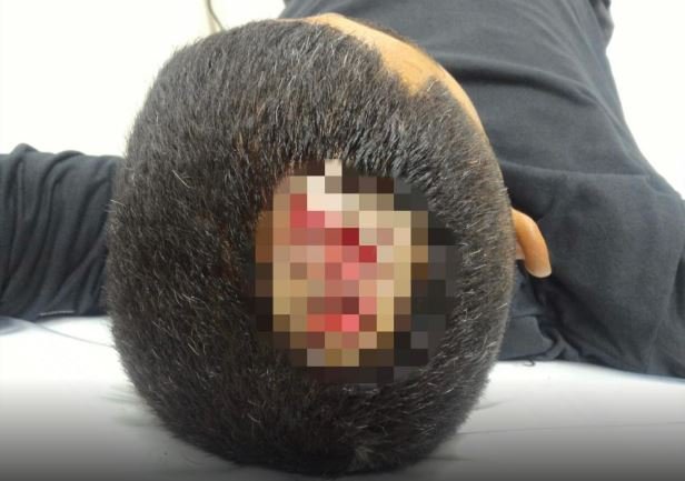 Criminosos tentam matar agente do Centro Socioeducativo de Lucas do Rio Verde, a pedradas