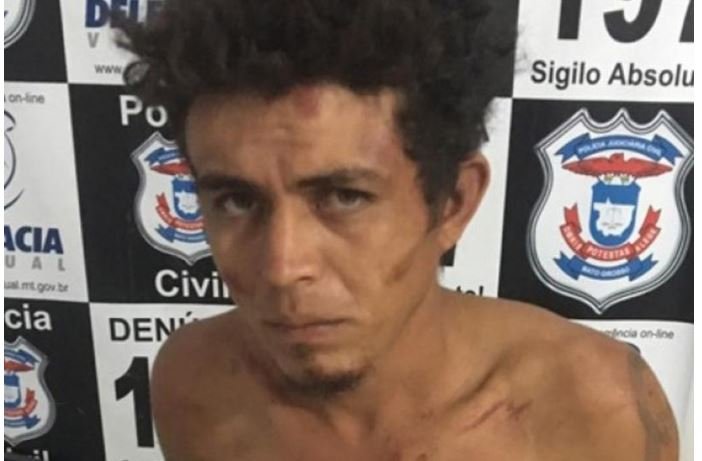 Marido é detido em flagrante após arrancar parte do lábio e do nariz de esposa em Itanhangá
