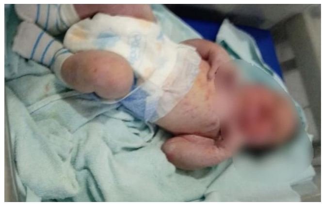 Mãe é presa após abandonar recém-nascido ao lado de formigueiro