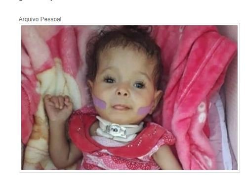 Mãe pede doações para custear aparelho de alimentação para filha