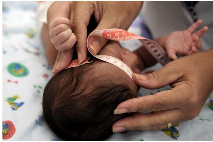 MP concede pensão vitalícia para crianças com microcefalia causada por zika