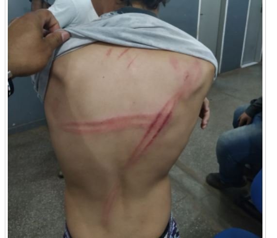 Padrasto tenta atropelar e espanca garoto de 14 anos com cabo de vassoura