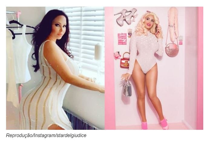 Mulher que já gastou R$1 milhão em plásticas agora quer ter “vagina da Barbie”