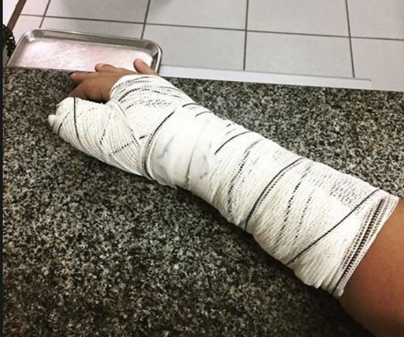 Menor tem suspeita de braço fraturado após briga entre irmãs em Colíder