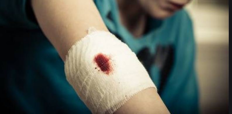 Adolescente em Colíder tem seu braço cortado dentro da sala de aula.