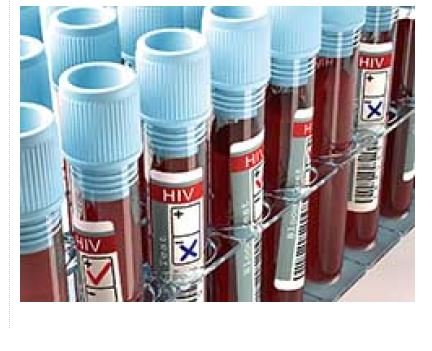Caso de Aids disparam em MT