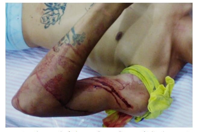 Jovem envolvido com tráfico de drogas é baleado em tentativa de execução em MT