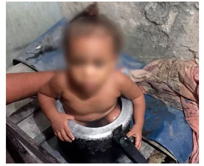 Menina entra em panela de pressão e fica presa