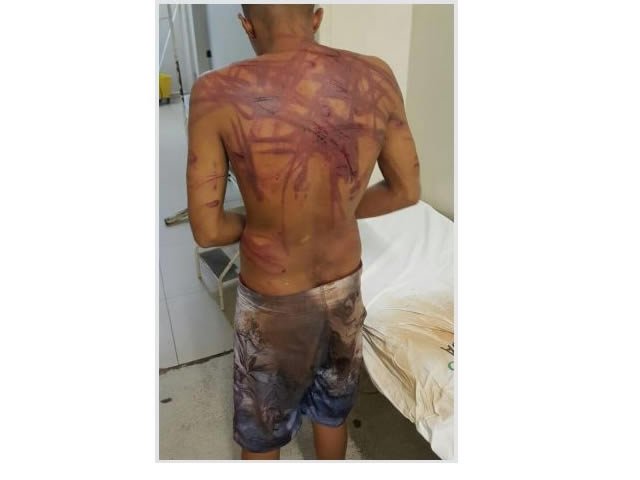 Durante a noite, rapaz de 19 anos é torturado por grupo de 8 homens