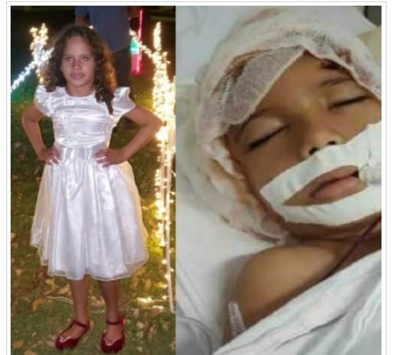 Menina de 6 anos perde couro cabeludo e orelhas após ser sugada por trator em fazenda de MT