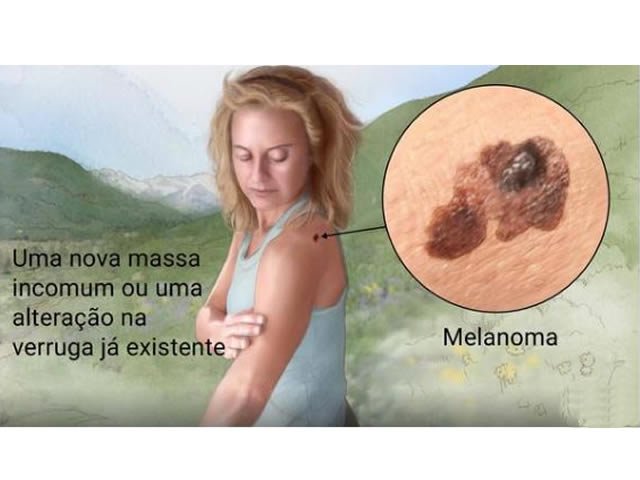 Mortalidade é maior a partir dos 30 anos em MT