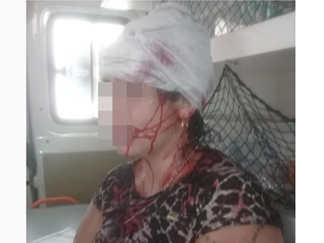 Mulher é agredida com barra de ferro ao recusar manter relacionamento com ex