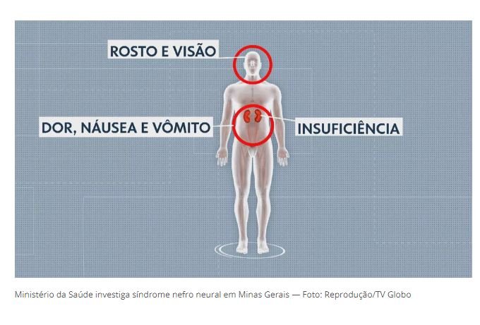 Dois novos casos de síndrome que matou em Minas são notificados em Belo Horizonte