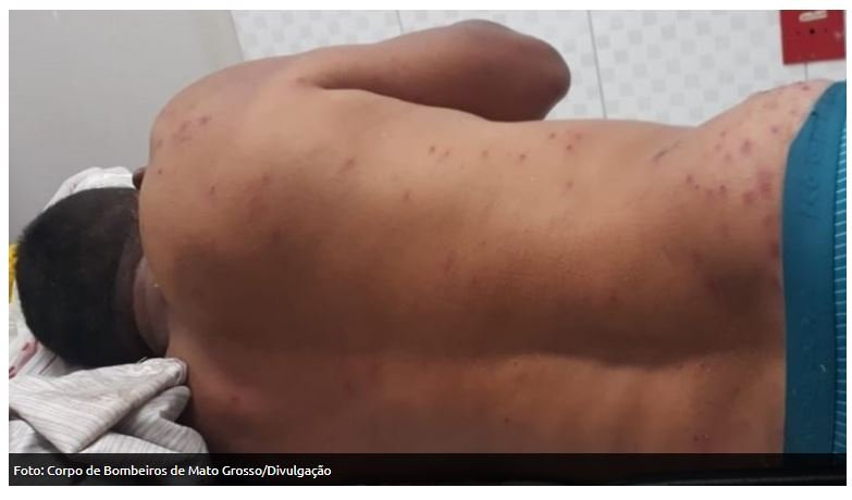 Trabalhador é atacado por abelhas durante limpeza de área em zona rural