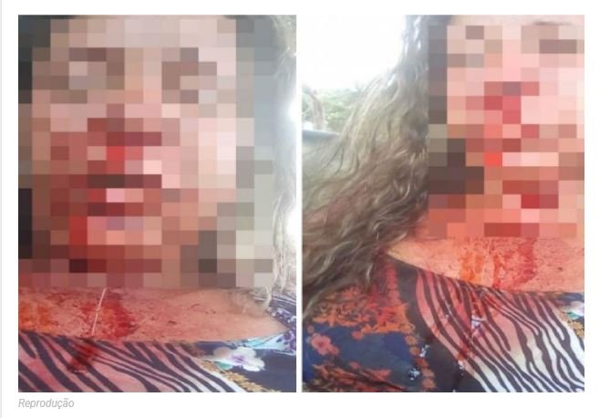 Mulher tem nariz quebrado após ser espancada na frente de crianças